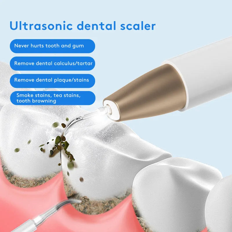 Gold-coloured ultrasonic tooth cleaner for removing tartar and surface stains on teeth.
