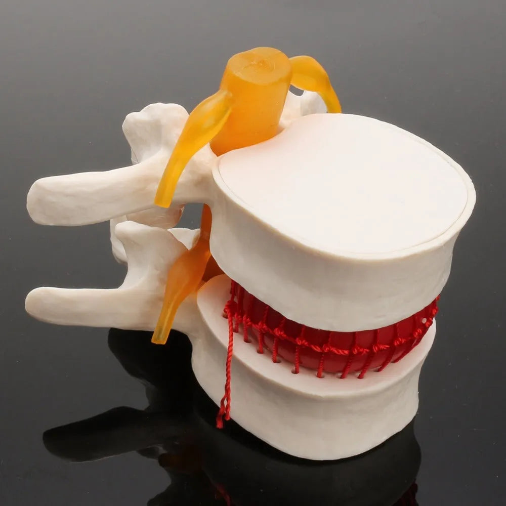 White PVC medical model of a human lumbar intervertebral disc for anatomy demonstration