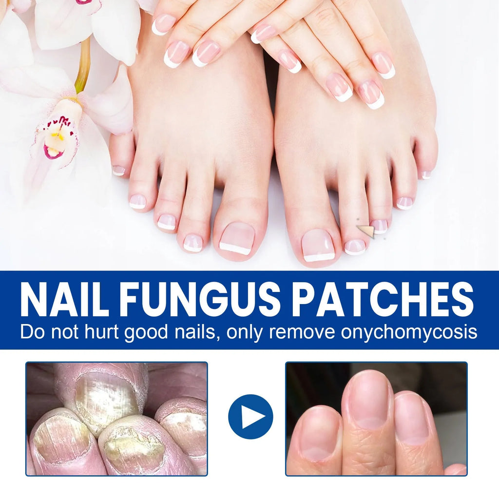 Box of 32 nail nursing adhesive bandage patches for nail repair, each patch 6.1cm by 3.5cm.