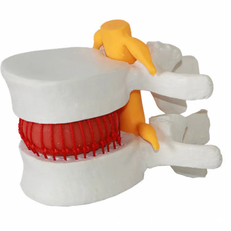 White PVC medical model of a human lumbar intervertebral disc for anatomy demonstration
