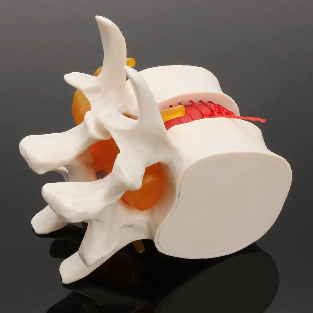 White PVC medical model of a human lumbar intervertebral disc for anatomy demonstration