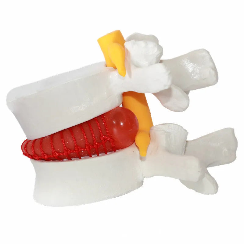 White PVC medical model of a human lumbar intervertebral disc for anatomy demonstration