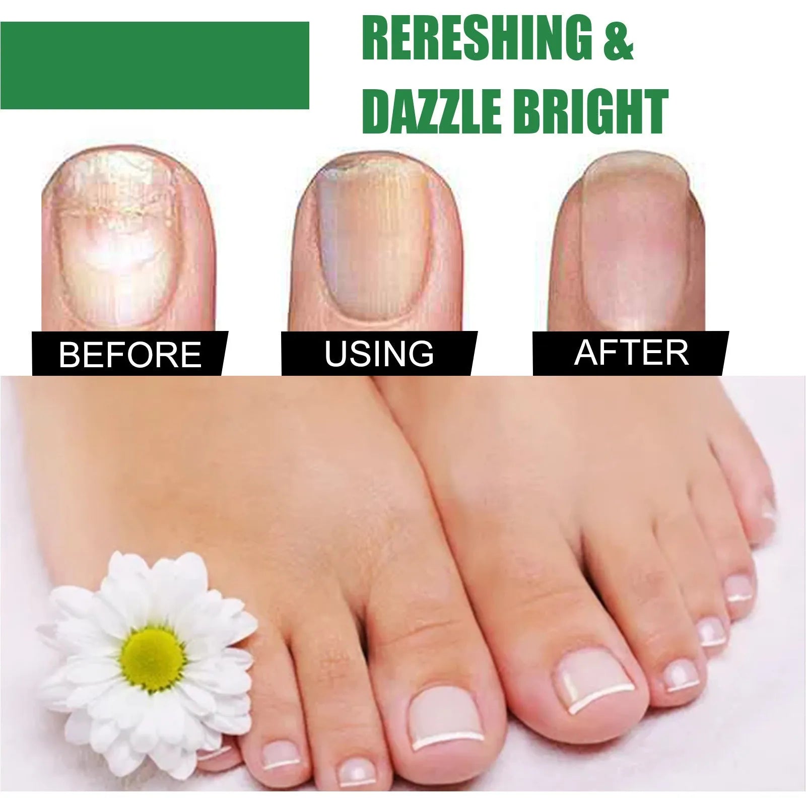 30ml bottle of tea tree oil nail repair solution for hand and foot care with thick nourishing formula