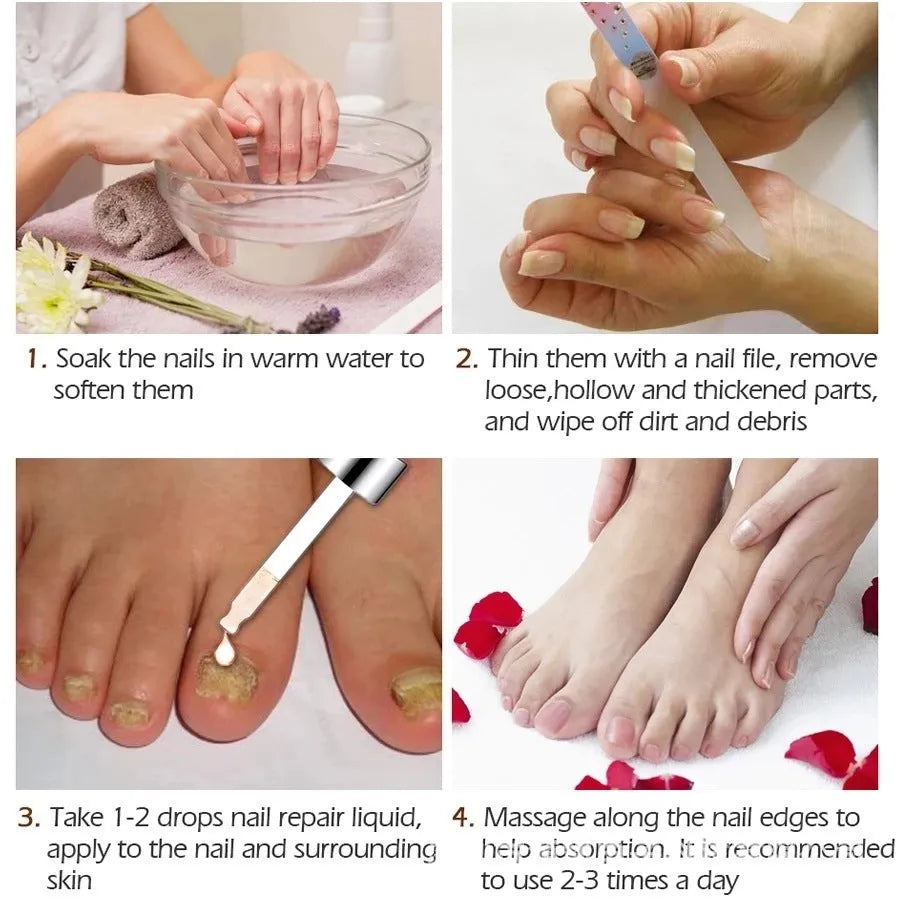 10ml whitenail antibacterial liquid applicator bottle for foot care and toenail treatment