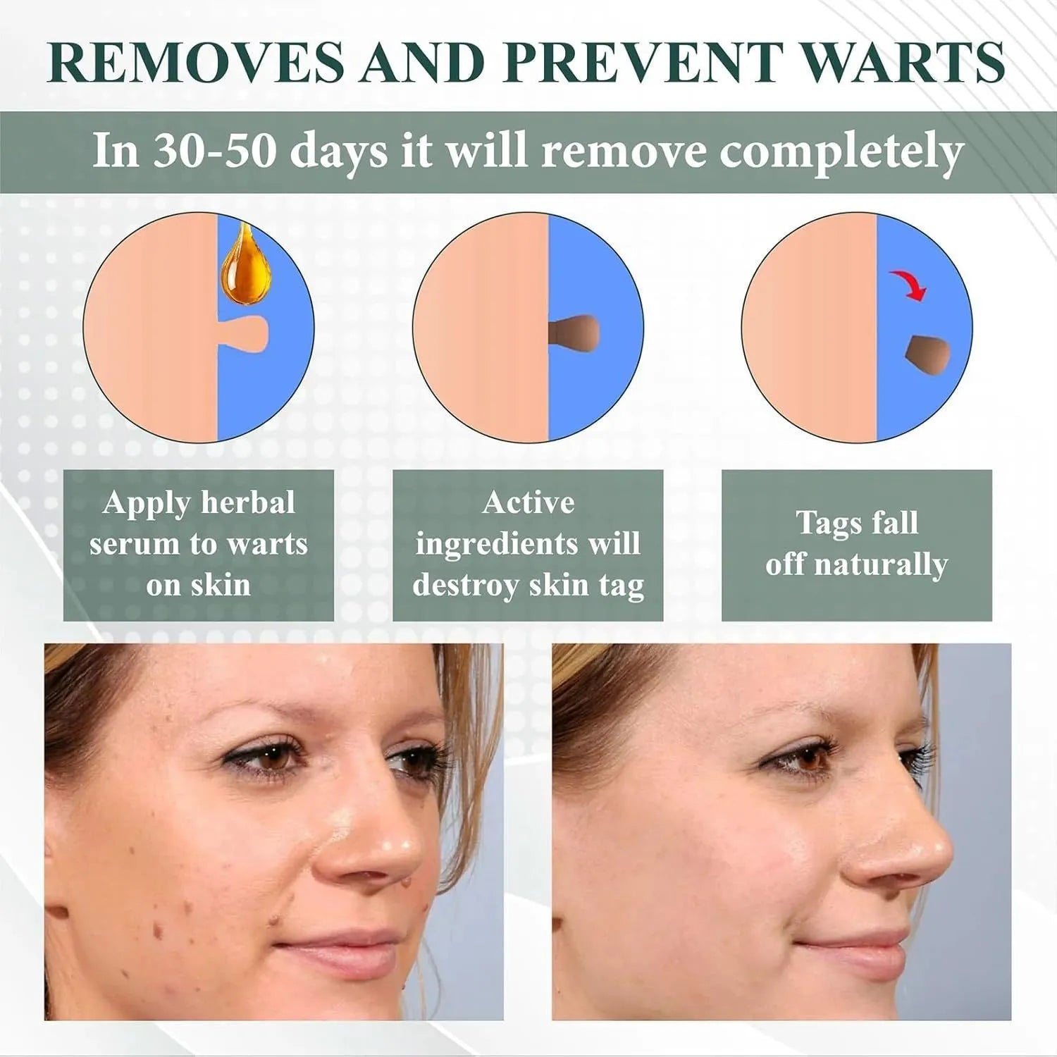 Natureerase 45g mole spot removal gel with hydrating formula and applicator