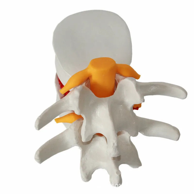 White PVC medical model of a human lumbar intervertebral disc for anatomy demonstration