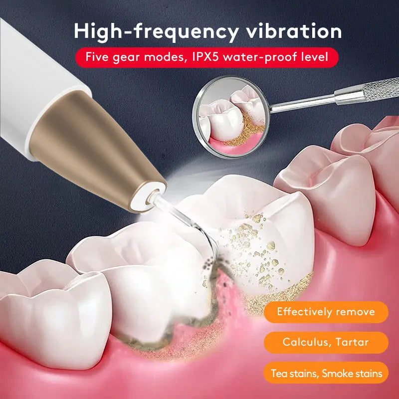 Gold-coloured ultrasonic tooth cleaner for removing tartar and surface stains on teeth.