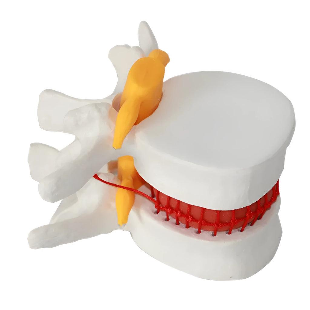 White PVC medical model of a human lumbar intervertebral disc for anatomy demonstration