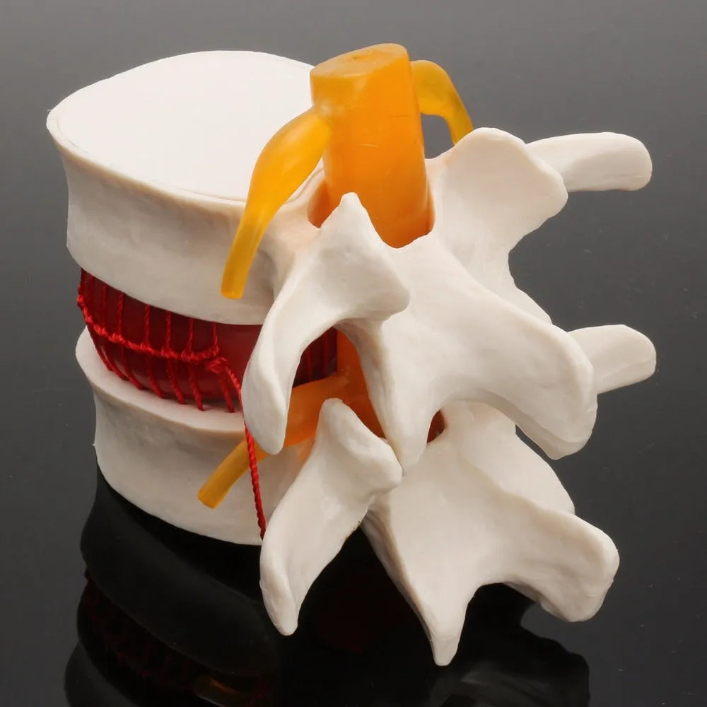 White PVC medical model of a human lumbar intervertebral disc for anatomy demonstration
