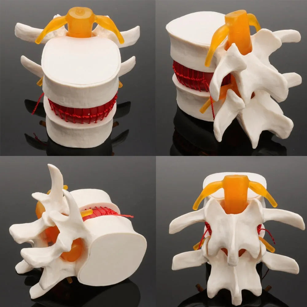 White PVC medical model of a human lumbar intervertebral disc for anatomy demonstration