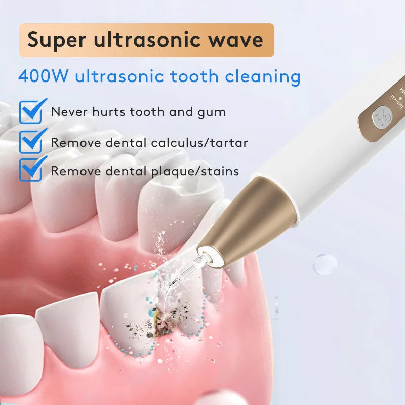 Gold-coloured ultrasonic tooth cleaner for removing tartar and surface stains on teeth.