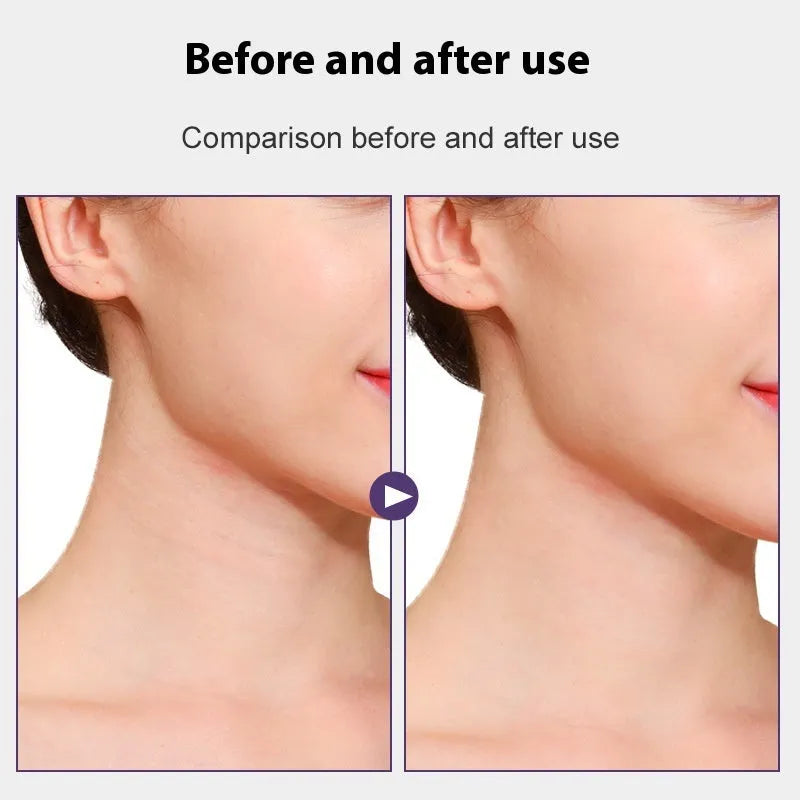 Skin tone neck firming adhesive tape with 4 packs and 20 patches for invisible neck support