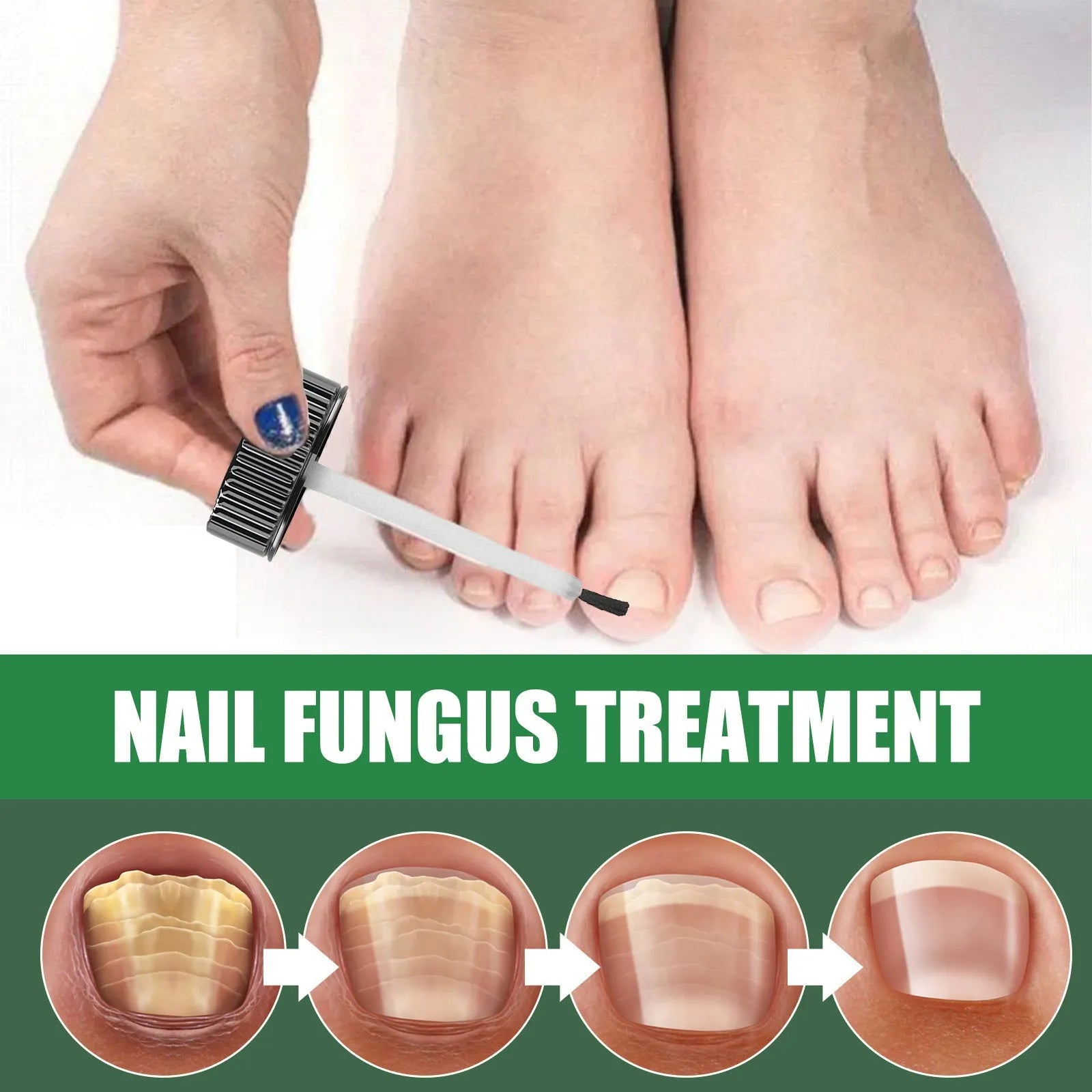 30ml bottle of tea tree oil nail repair solution for hand and foot care with thick nourishing formula