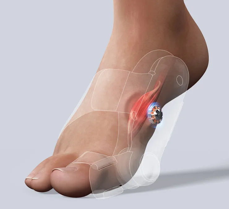 White plastic electric hallux valgus toe separator with USB Type-C charging port
