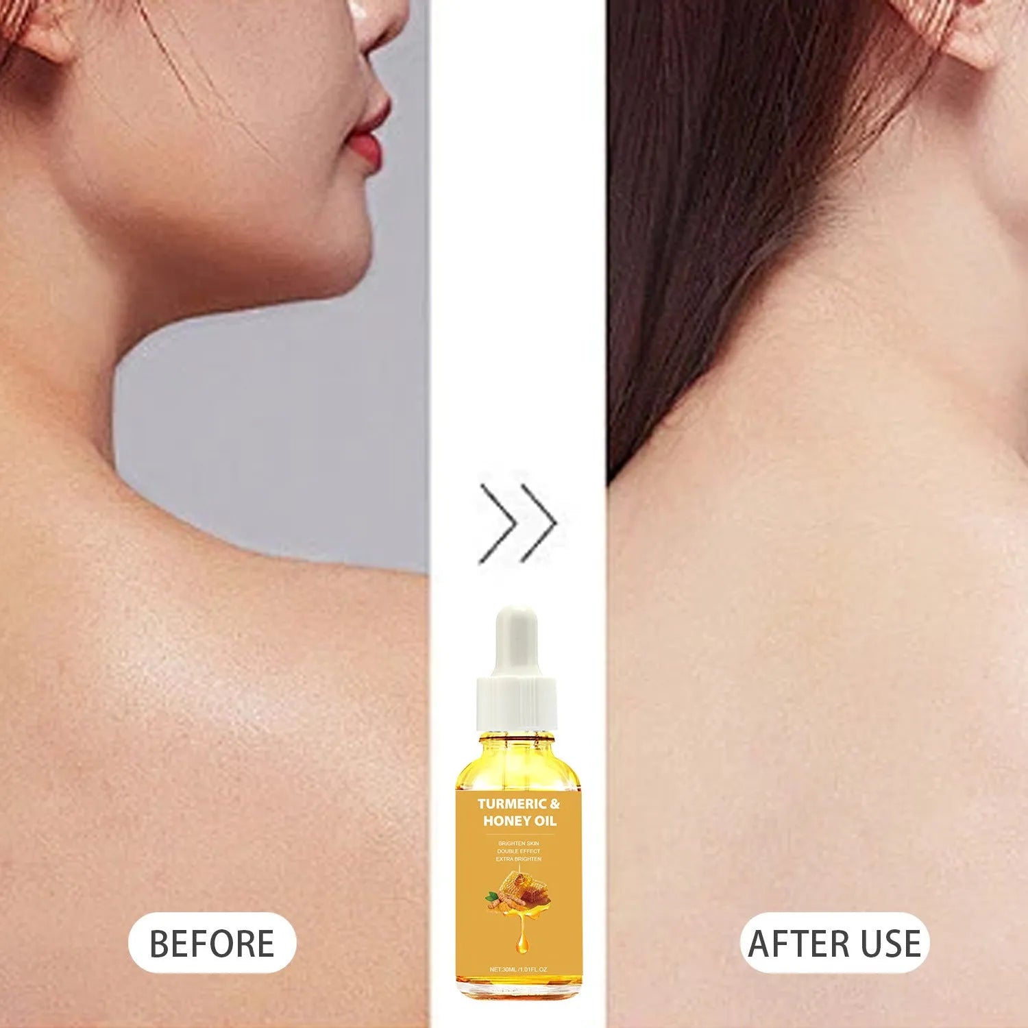 30ml amber glass bottle of turmeric honey essential oil with dropper in neutral packaging