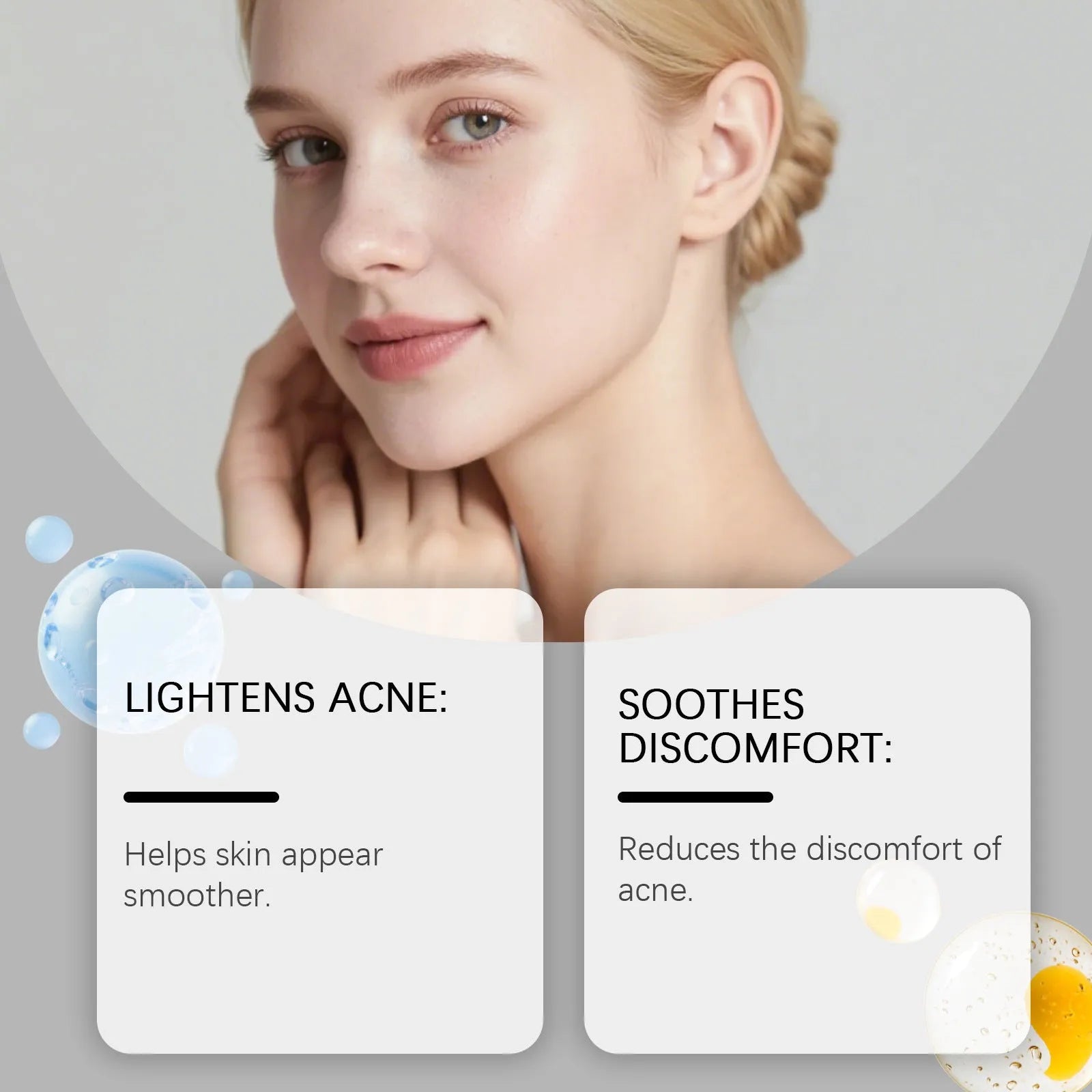 Hydrocolloid facial acne patches pack with 80 gentle breathable patches for skincare