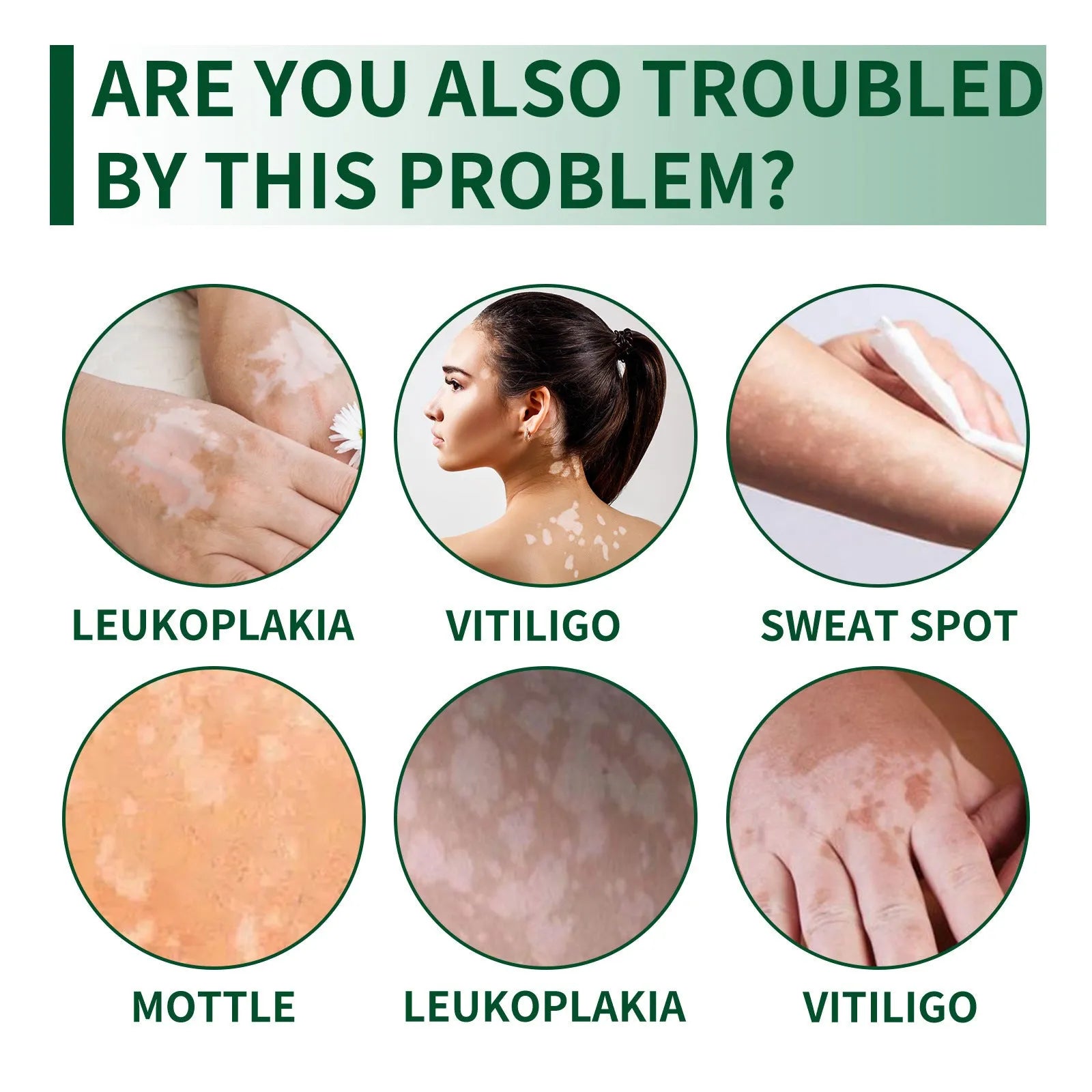 35g body care cream container for orange peel tissue treatment with cleansing and moisturising properties