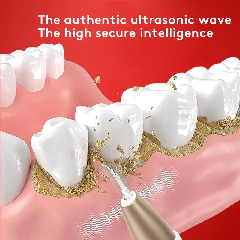 Gold-coloured ultrasonic tooth cleaner for removing tartar and surface stains on teeth.